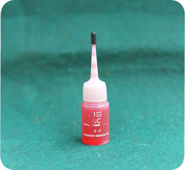 カリエスディテクター