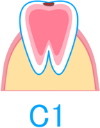 C1